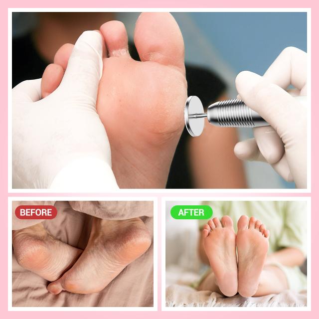 60 Pcs Replacement Sandpaper Discs with 25mm Metal Nail Drill Bit