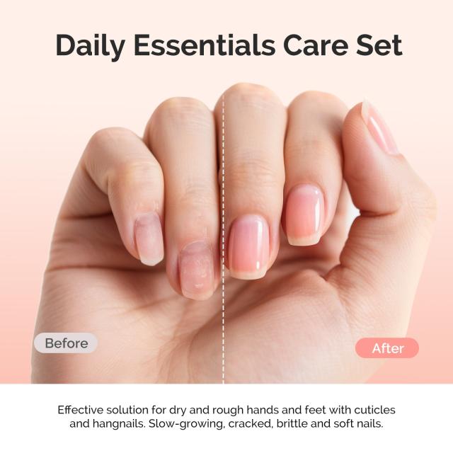 TPO-Free Cuticle Care Kit 25ml - Cuticle Oil and Cuticle Remover