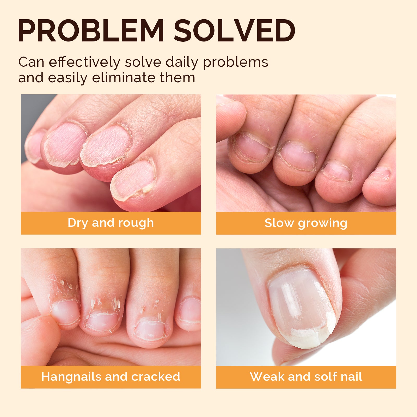 TPO-Free Cuticle Oil Pen Set - Image7