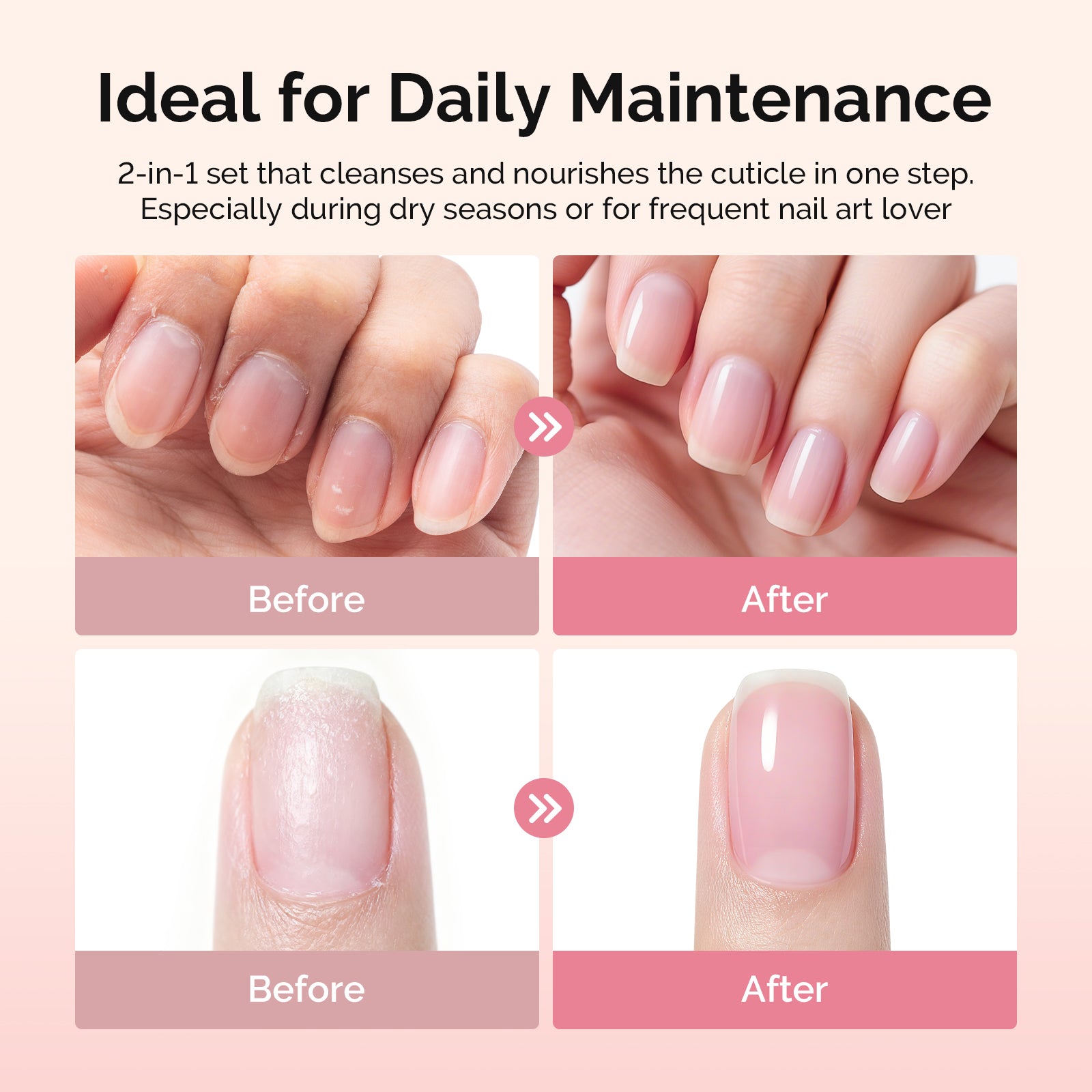 Cuticle Remover Kit - 图片3