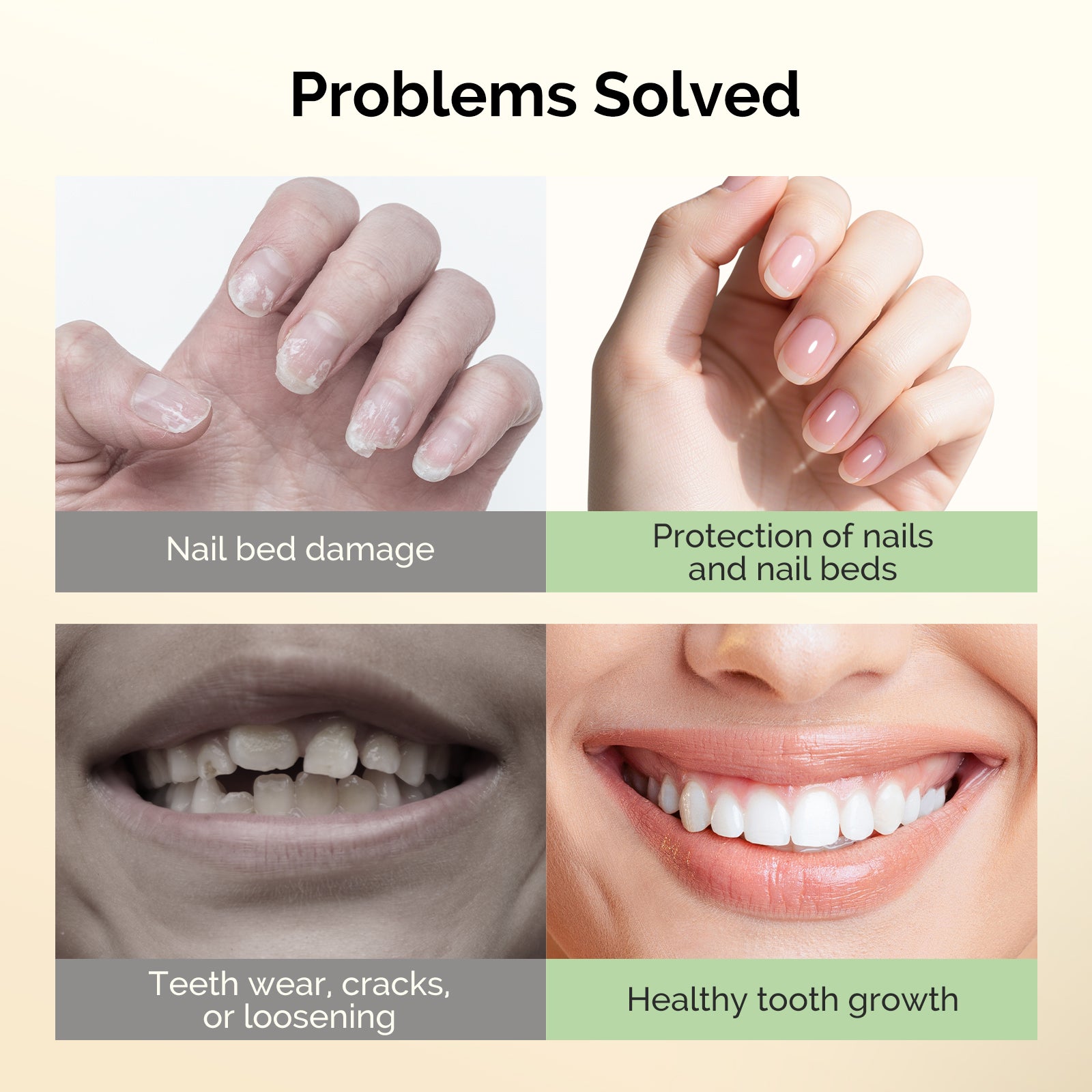 Nail Biting Treatment 15ml - 图片4