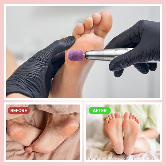 Nail Sanding Caps With A Rubber Mandrel Bit Purple - 10mm