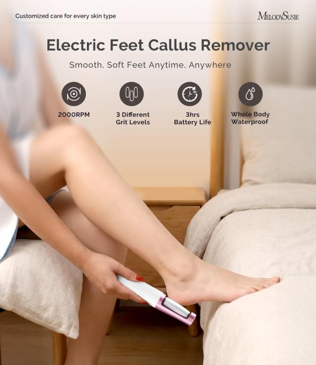 PC800G Rechargeable Feet Callus Remover - White Rose