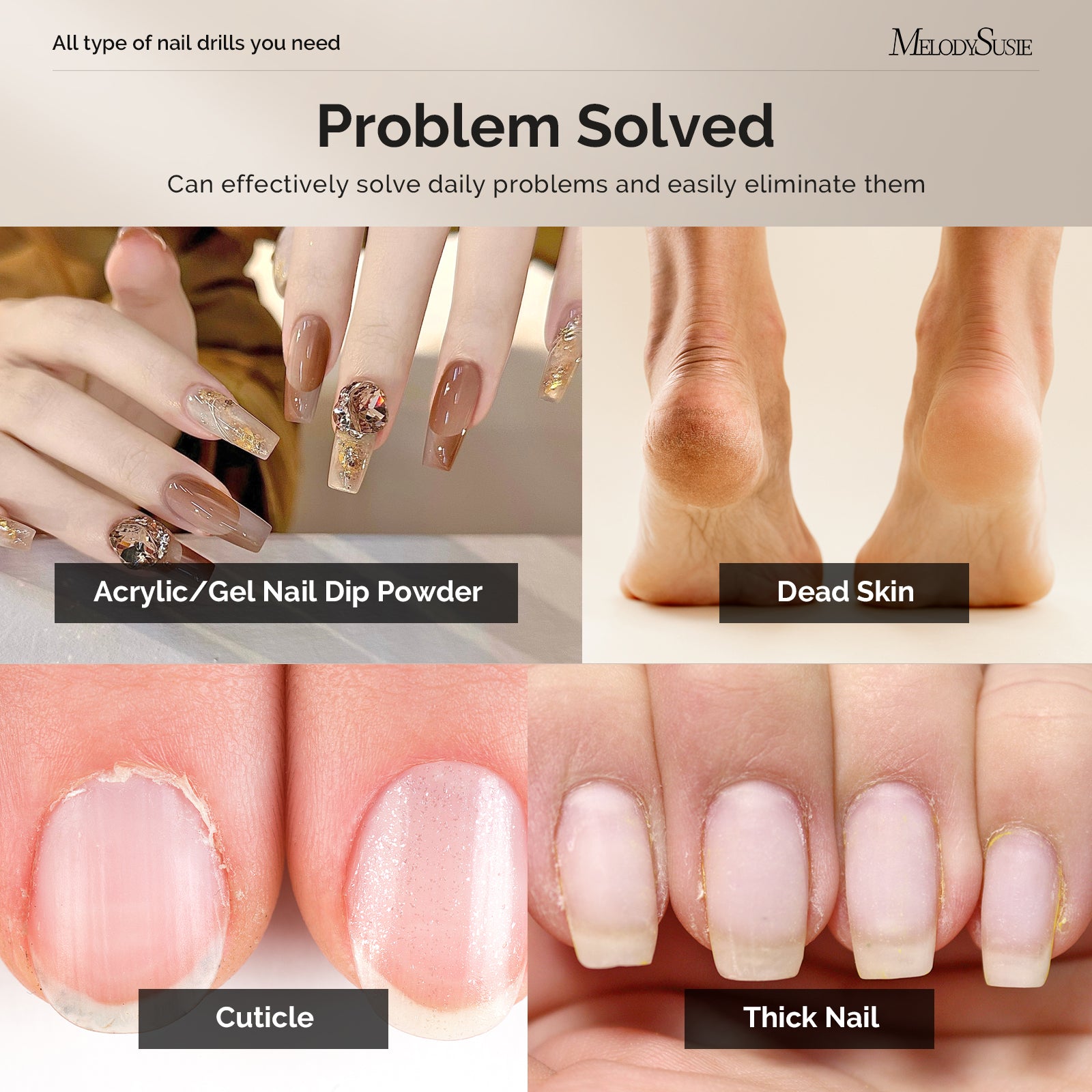 PM170F & HPRO & P-Plus30F - Home Essentials Kit - 图片5