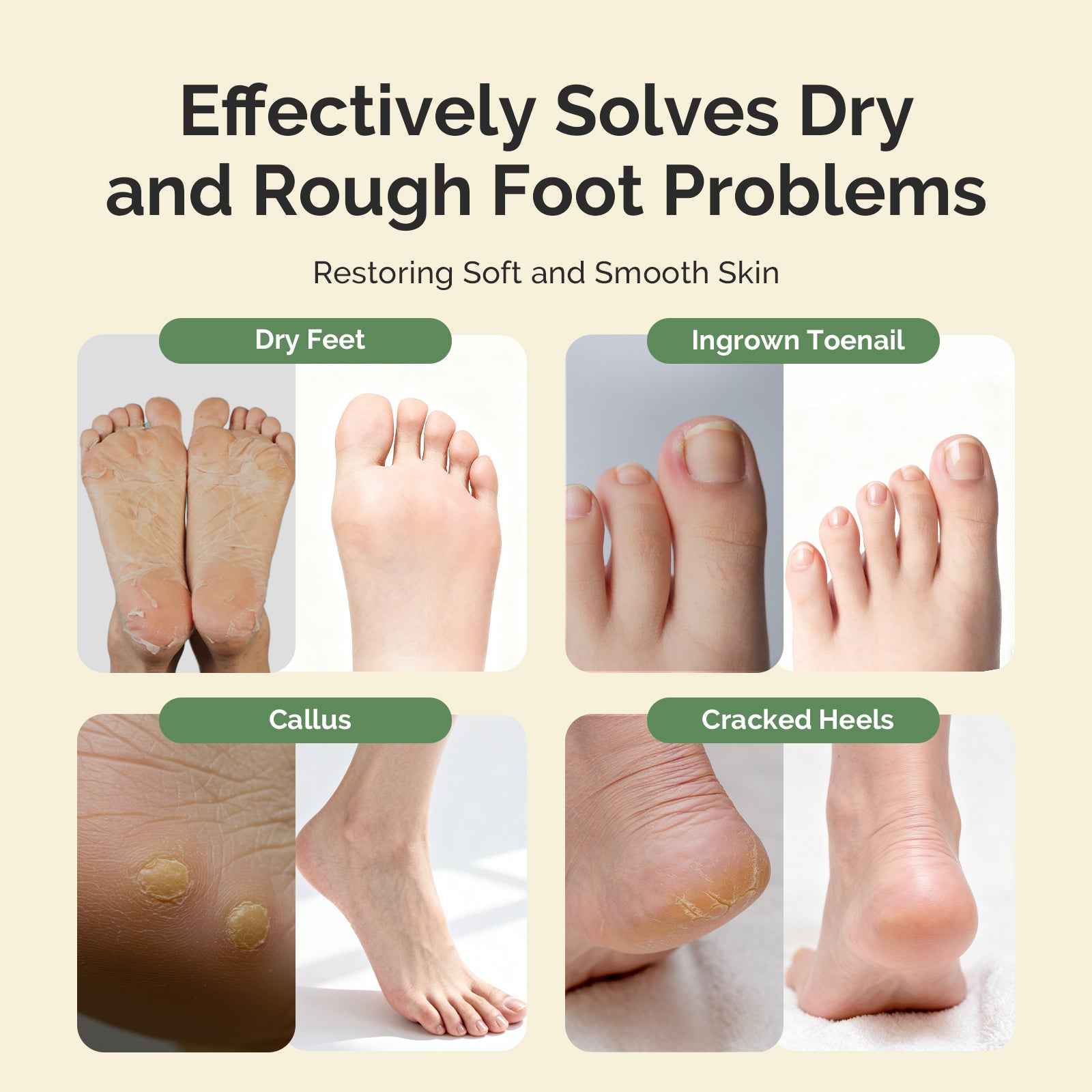 Tea Tree Oil Foot Soak with Sea Salt - 图片3
